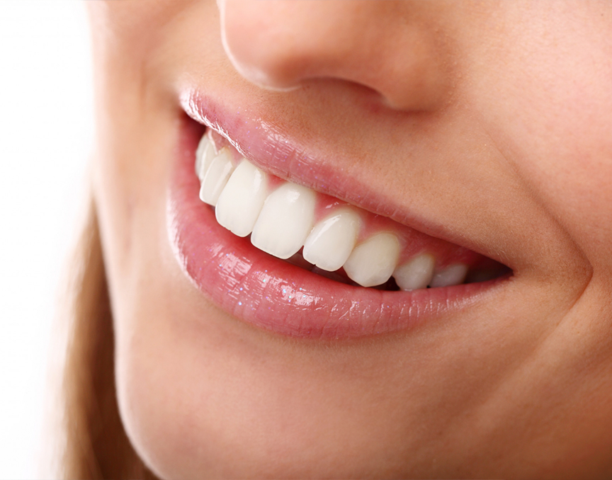 Как отбелить зубы в домашних условиях - 11 рабочих способов